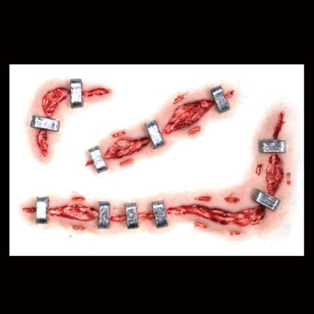 Staplestein 3D Fx Tinsley Transfer